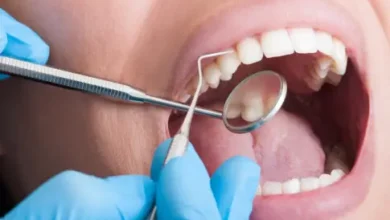 Cosmetic Bonding: A Subtle Yet Powerful Fix