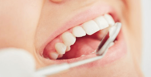 5 Common Myths About Cosmetic And Restorative Dentistry