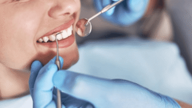 How Cosmetic Dentistry Addresses Stains, Chips, and Gaps